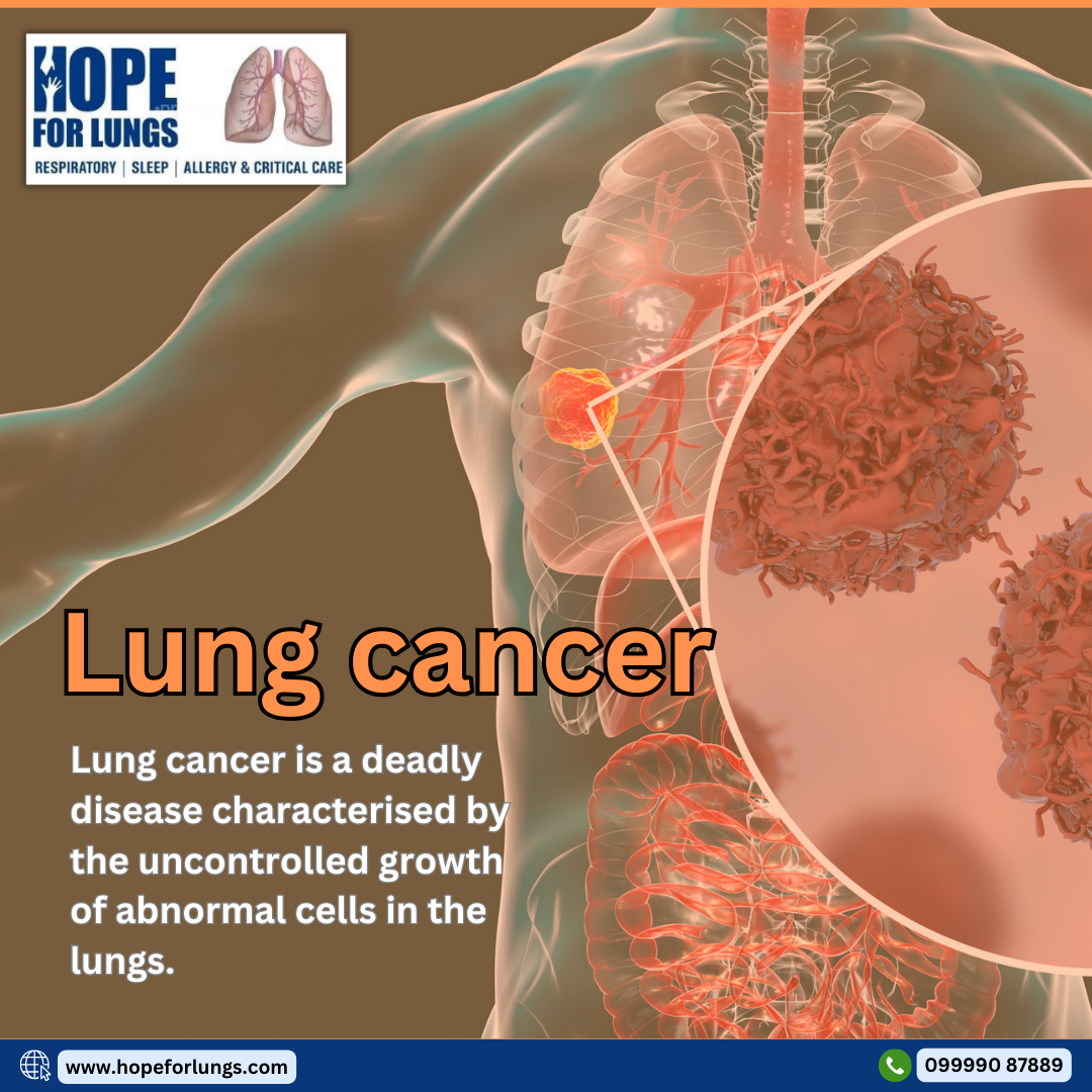 Lung cancer